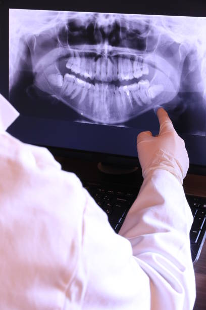 Best Emergency Wisdom Teeth Removal in Hockessin, DE